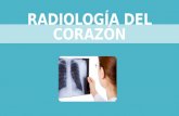 Radiología del corazón