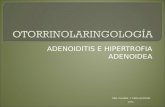 Hipertrofia adenoidea