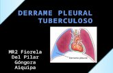 Derrame pleural tuberculoso, 2015