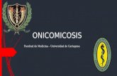 Onicomicosis 140415111935-phpapp01