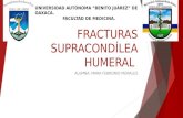 Fracturas supracondílea humeral