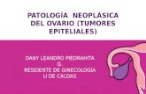 Patología  neoplásica del ovario