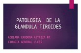 Patologia de la glandula tiroides