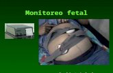Obstetricia monitoreo-fetal-anteparto