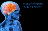 Esclerosis multiple ..