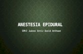 Anestesia epidural en caballos