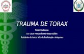 Trauma de torax Dr. Martínez Guillén