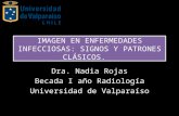 SIGNOS Y PATRONES CLASICOS DE PATOLOGIA PULMONAR EN TC