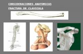 fractura clavicula.ppt
