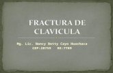 Fractura de Clavicula.