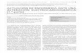 interpretación electrocardiográfica