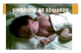 sindrome de edwards.pptx