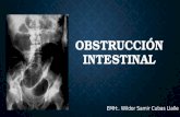 Obstrucción Intestinal 2015