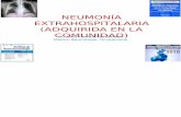 Neumonía Extrahospitalaria (Adquirida en La Comunidad) (5)