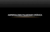 Aspergilosis Pulmonar Crónica