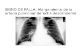 Radiologia Trombo Embolo Pulmonar