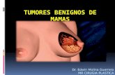 Tumores Benignos de Mamas