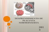 Desprendimiento de Placenta Normoinserta