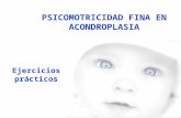 Psicomotricidad Fina Acondroplasia