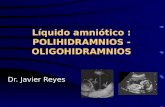 [Clase07 - Seminario 2] La Oligo y Polihidramnios (Dr Reyes)
