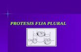 Protesis Fija Plural