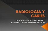 Radiologia y Caries