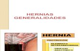 HERNIAS GENERALIDADES.ppt