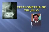 111526253 Analisis Cefalometrico de Trujillo