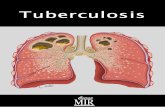 10 Tuberculosis Curso Mir