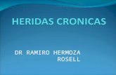 HERIDAS CRONICAS ii.ppt