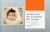 Síndrome de Cornelia de Lange 2° parte