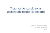 Trauma Dento Alveolar1