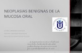Neoplasias Benignas de La Mucosa Oral