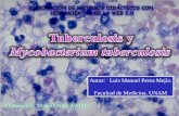 Tuberculosis- Luis M Perea