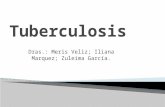 Tuberculosis Seminario 2.pptx