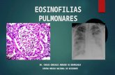 Eosinofilias pulmonares
