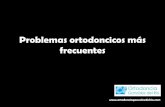 Problemas ortodoncicos más frecuentes