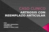 Caso Clinico Artrosis