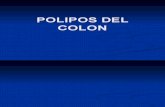 Polipos Del Colon