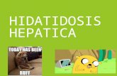 Hidatidosis Hepatica