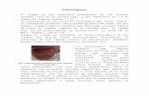 Fibrolipoma, patología