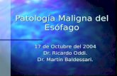 Patología Maligna de Esofago