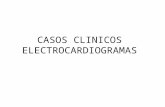 CASOS CLINICOS ELECTROCARDIOGRAMAS