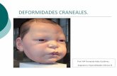 3.-DEFORMIDADES CRANEALES bebes