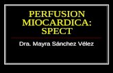 PERFUSION MIOCARDICA: SPECT Dra. Mayra Sánchez Vélez.