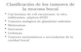 Clasificación de los tumores de la mucosa bucal Carcinomas de cell escamosas: in situ, infiltrantes, atípicos (POF) Tumores malignos de glándulas salivales.