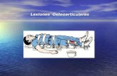 Lesiones Osteoarticulares Las emergencias traumáticas y ortopédicas constituyen una de lesiones mas frecuentes que diariamente ocurren debido a accidentes.