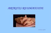 ARTRITIS REUMATOIDE Cristina Capilla Definición La Artritis Reumatoide (AR) es una poliartritis crónica simétrica y erosiva que debe sospecharse en pacientes.