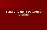 Ecografía de la Patología Uterina. Ecografía de la Patología Obstétrica Endometriosis Endometriosis Adenomiosis Adenomiosis Miomas Miomas Pólipos endometriales.