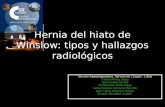 Hernia del hiato de Winslow: tipos y hallazgos radiológicos Servicio Radiodiagnóstico. Servicio de Cirugía*. CHOU Cristina Pérez López Laura Casal Da Vila.